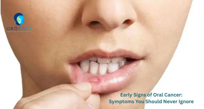 Learn about the early signs of oral cancer, risk factors, diagnosis, treatment, and prevention. Consult an experienced Oral Surgeon in Pimpri Chinchwad or Oral Surgeon in Pune for timely evaluation and expert care